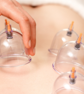 cupping